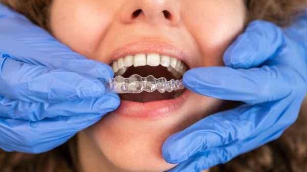 Invisalign Stockport