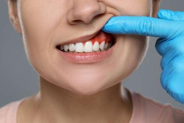 emergency dentist in Loughborough 
